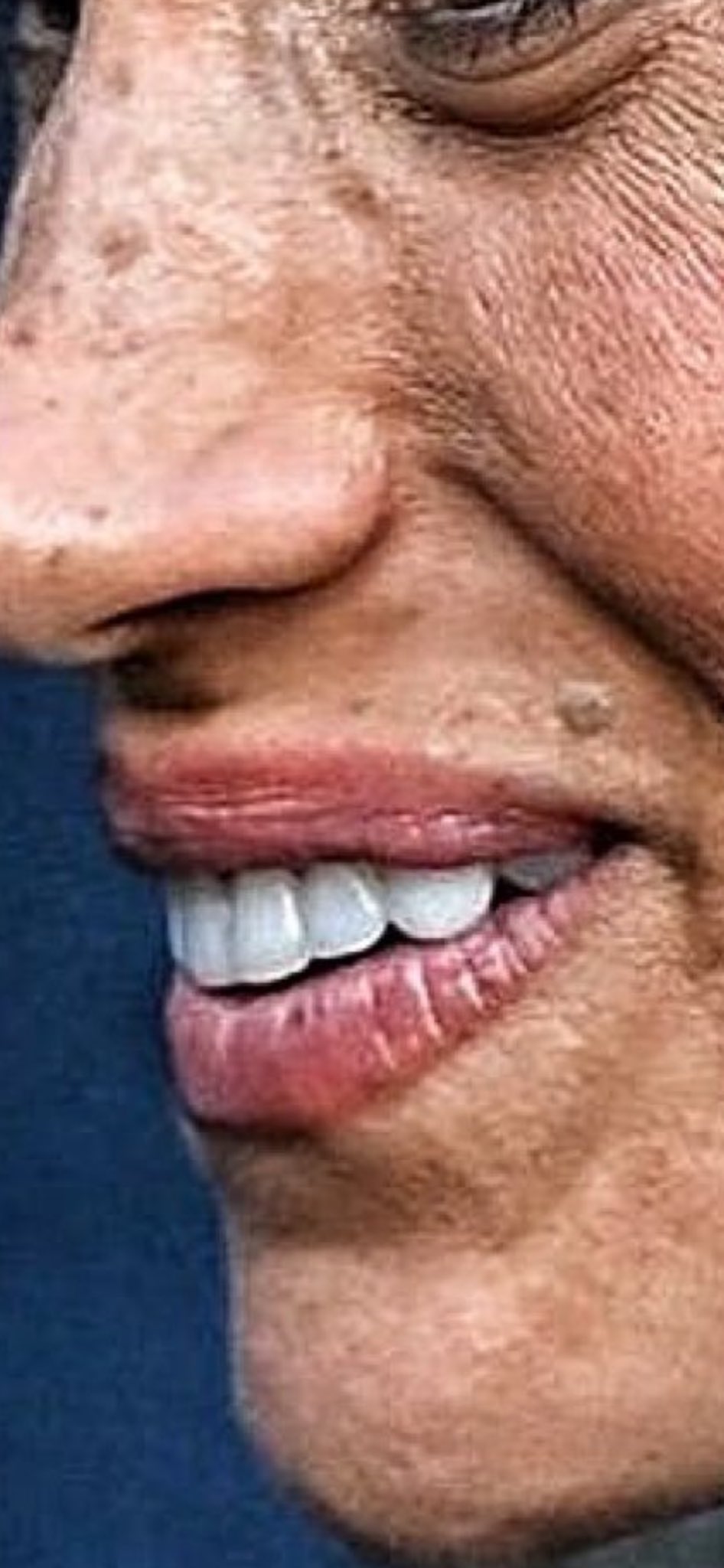 1000885915