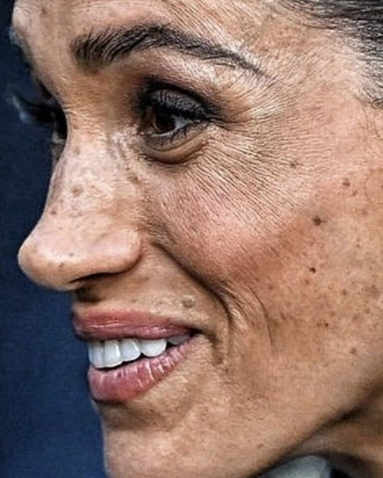 1000987256